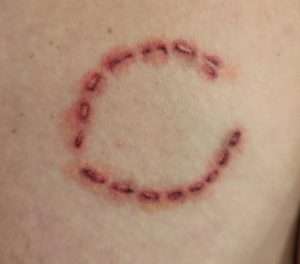Bite Mark Tattoo Meaning